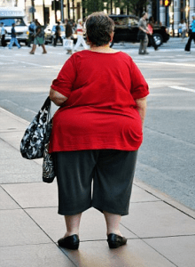 Obesidad